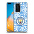 Manchester City Man City FC Graphics Sky Blue Pattern Fight Soft Gel Case for Huawei P40 Pro / P40 Pro Plus 5G