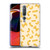 PLdesign Food Patterns Macaroni Pasta Gold Soft Gel Case for Xiaomi Mi 10 5G / Mi 10 Pro 5G