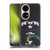 Liam Gallagher Graphics Rkid Soft Gel Case for Huawei P50