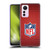 NFL Shield Football Soft Gel Case for Xiaomi 12 Lite