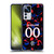 Custom Customised Personalised Rangers FC 2024/25 Kit Third Soft Gel Case for Xiaomi 12T Pro