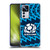 Scotland Rugby 2025/26 Crest Kit Training Soft Gel Case for Xiaomi 12T Pro
