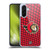NHL Ottawa Senators Net Pattern Soft Gel Case for Samsung Galaxy A36 5G