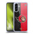 NHL Ottawa Senators Half Distressed Soft Gel Case for Samsung Galaxy A56 5G