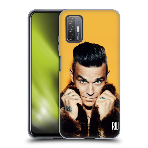 Robbie Williams Calendar Fur Coat Soft Gel Case for HTC Desire 21 Pro 5G
