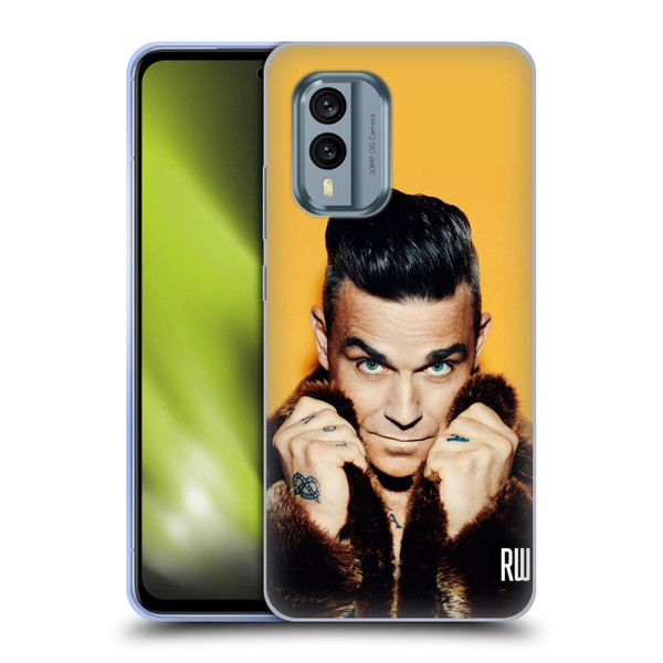Robbie Williams Calendar Fur Coat Soft Gel Case for Nokia X30