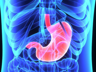 Averting Diverticulitis