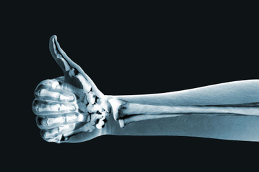 Essential Vitamins & Minerals for Bone Health Explained