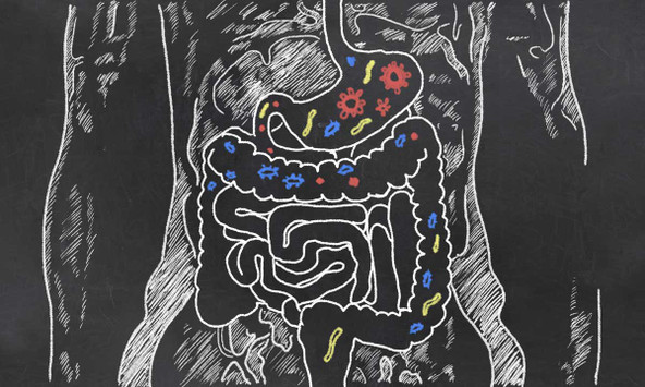 Severe COVID and Gut Dysbiosis