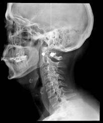 Exploring X-Ray Mutations: Uncovering Hidden Secrets
