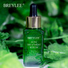 BREYLEE 40ml Acne Treatment Serum Face Facial Essence Anti Acne Scar Removal Cream Skin Care Whitening Pimple Remover For Acne|Serum|