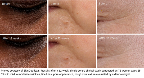 SkinCeuticals P-TIOX