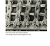 Knit structure cellulose acetate: (Scanning Electron Micrograph (x20)