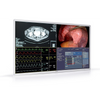 Barco MDSC‑8255 55" Surgical Monitor