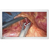 Eizo CuratOR EX2721 27" Surgical Monitor