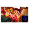 EIZO CuratOR EX5841 58"