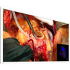 Eizo CuratOR EX5841 58" Surgical Monitor