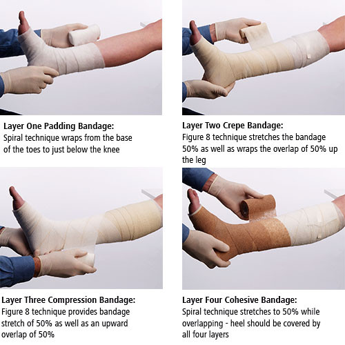 FourPress Compression Bandage SystemFourPress Compression Bandage System