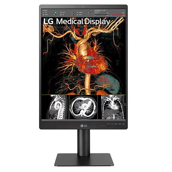 LG 21HQ513D-B 21.3-inch 3MP Diagnostic Monitor