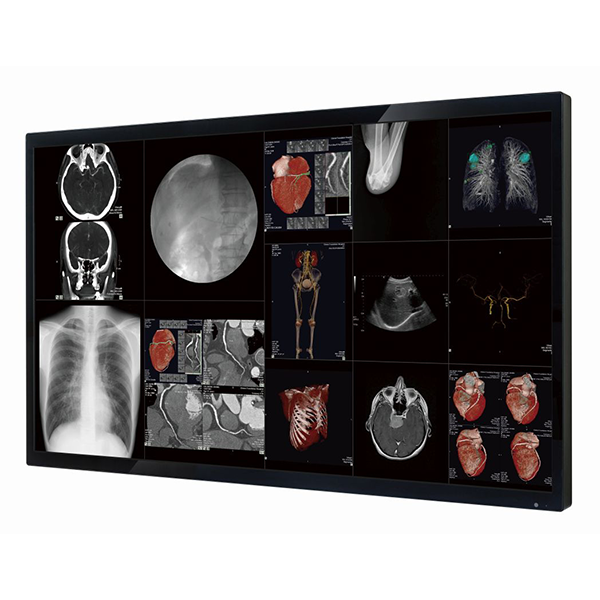 Optik View SC65812 65” Surgical Monitor