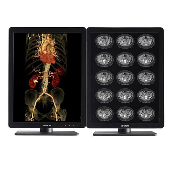 Barco MDNC-3521 3MP 21" Radiology Monitor