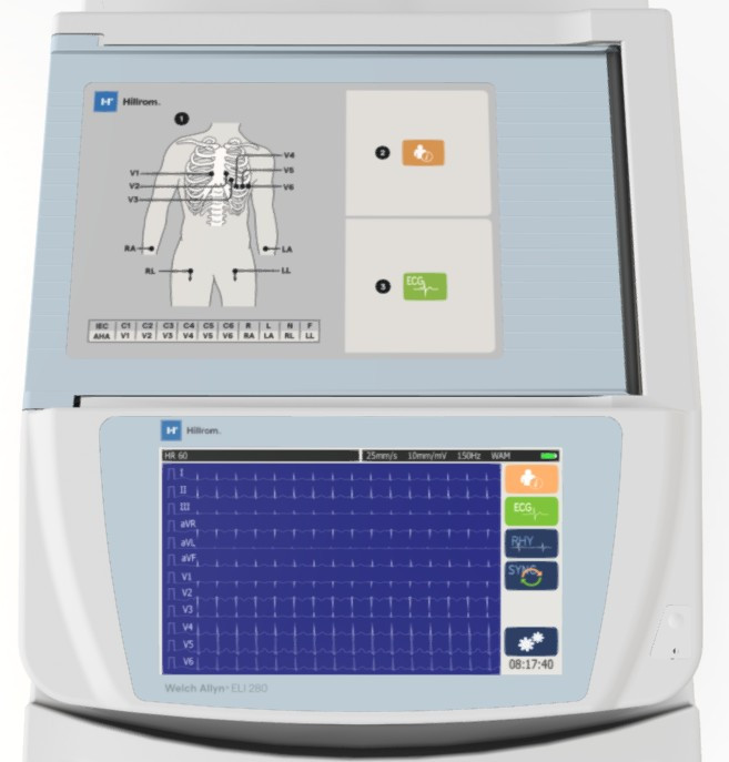 ELI 280 12-Lead Resting ECG – AM12 Wired DICOM