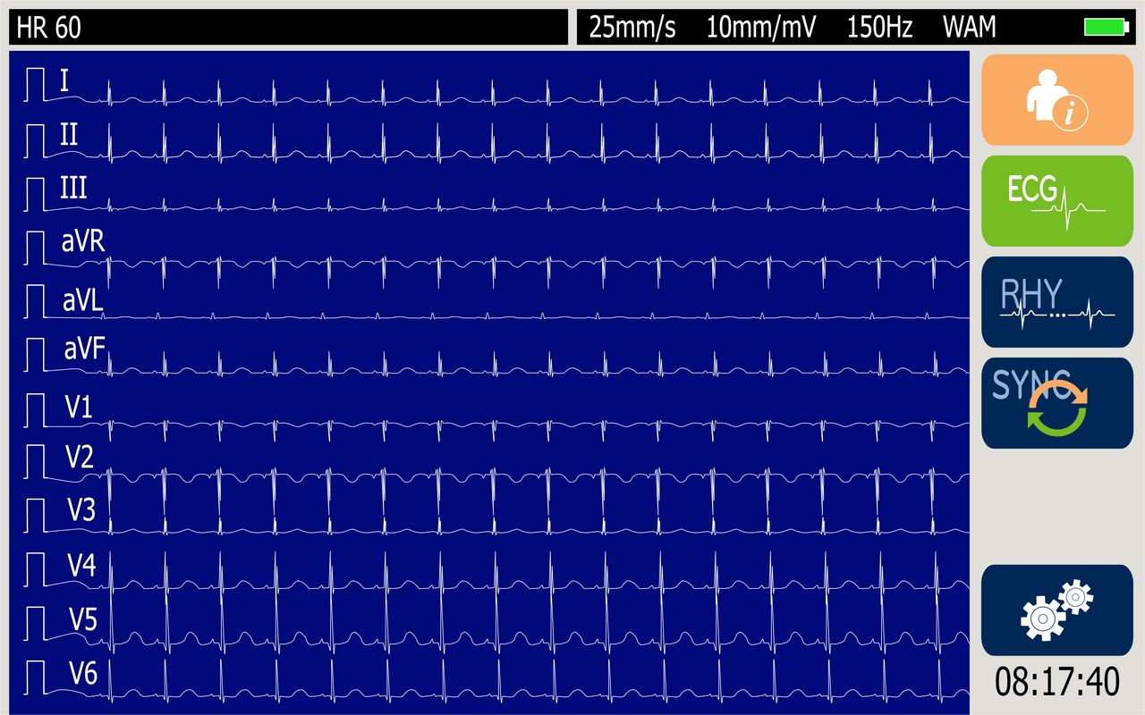ELI 280 12-Lead Resting ECG – AM12 Wired DICOM