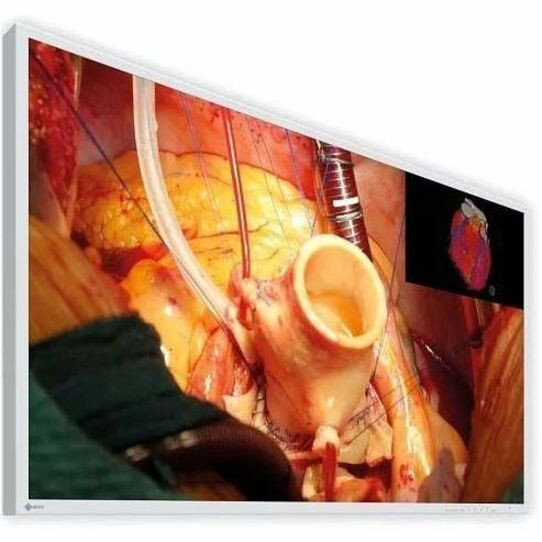 Eizo CuratOR EX4342 43" Surgical Monitor
