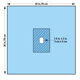 Halyard Health Surgical Drapes Minor Procedure Fenestrated