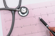 ECG Interpretation: How to Read an Electrocardiogram