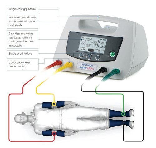 Huntleigh Dopplex ABility Automatic ABI System