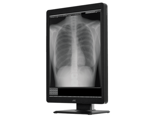 JVC MS-300 21.3" Radiology Monitor
