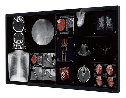 Optik View DC5821 Surgical Monitor
