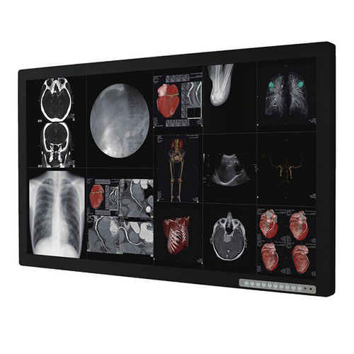 Optik View 55” SC55820 Surgical Monitor