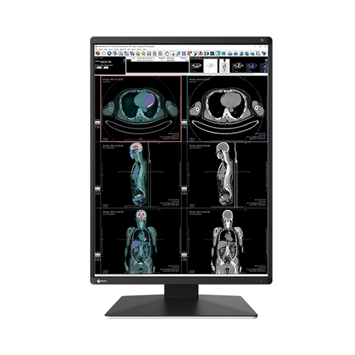 Eizo RX370 3MP 21" Radiology Monitor