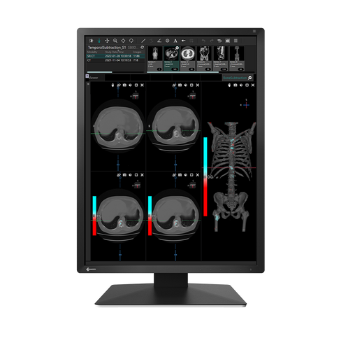 Eizo MX 217 2MP 21" Radiology Monitor