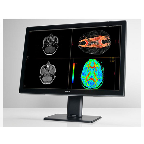 Barco Coronis Fusion 6MP 30" MDCC-6530 Radiology Monitor