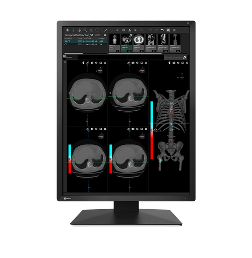 Eizo MX 217 2MP 21" Radiology Monitor