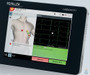 Schiller CARDIOVIT FT-1 Tablet ECG Machine