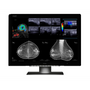 Barco MDMC-12133 12MP Radiology Monitor 