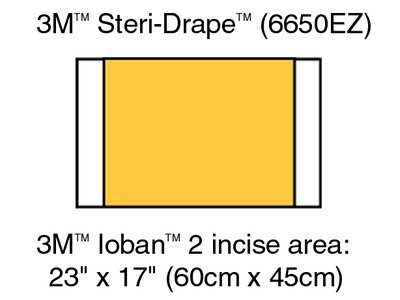 3M Ioban 2 Antimicrobial Incise Drape 6650EZ