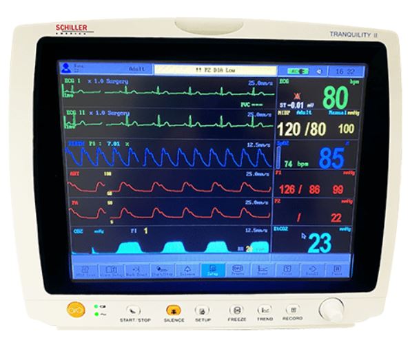 Tranquility II Vital Signs Monitor With ISA Side Stream Analyzer And Printer