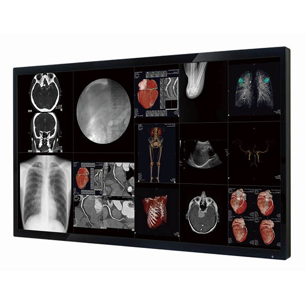 Optik View SC65812 65" 4K Surgical Monitor