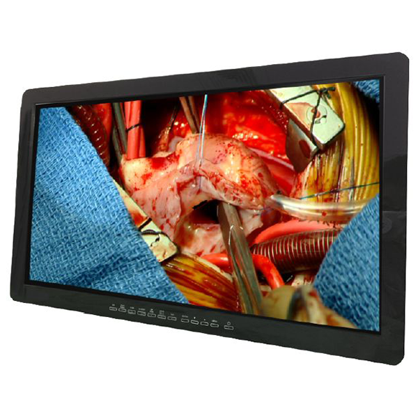 Optik View SC27210 27" FHD Surgical Monitor