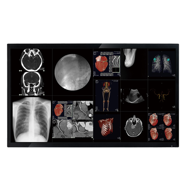Optik View DC4081X 40" 4K Surgical Monitor
