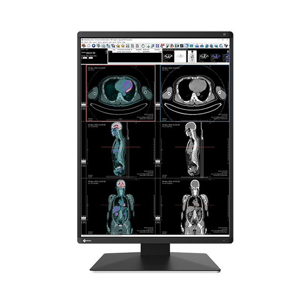 Eizo RX370 3MP 21" Radiology Monitor