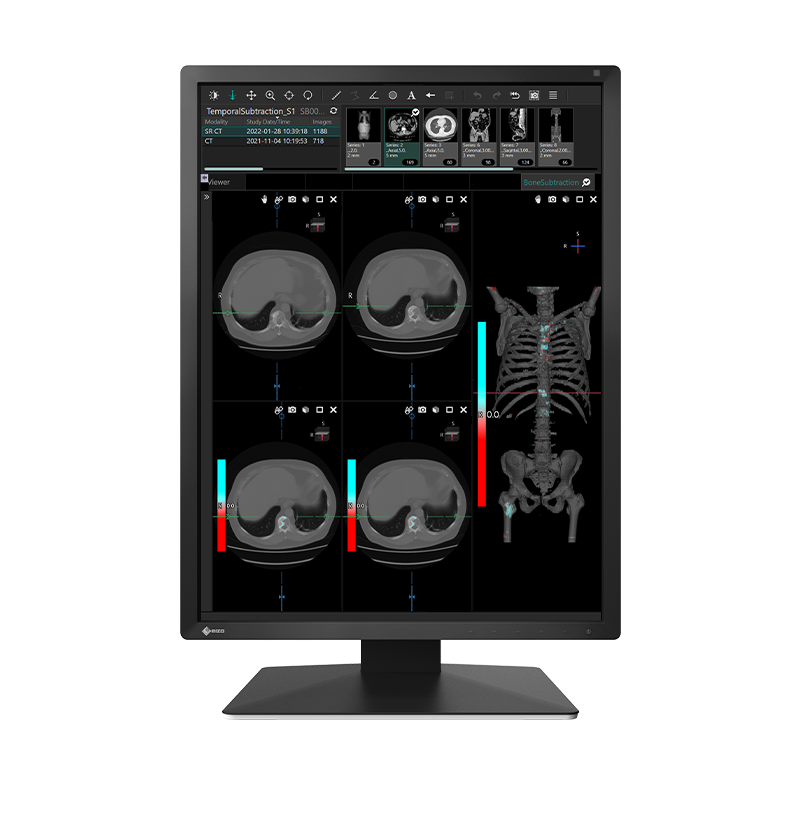 Eizo MX217 2MP 21" Radiology Monitor