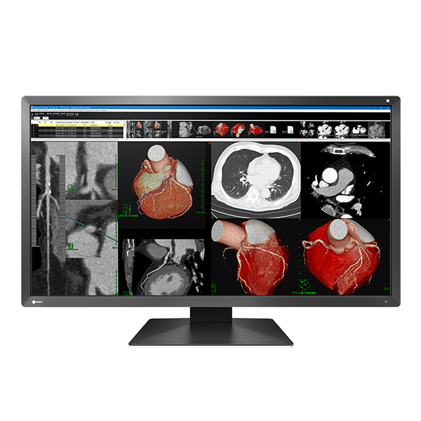 Eizo MX317W-BK 8MP 30" Radiology Monitor
