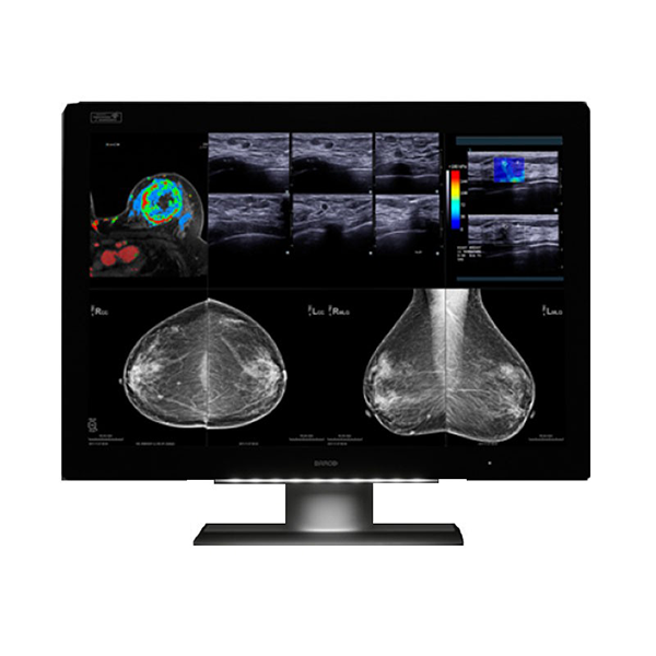 Barco MDMC-12133 12MP 33" Radiology Monitor
