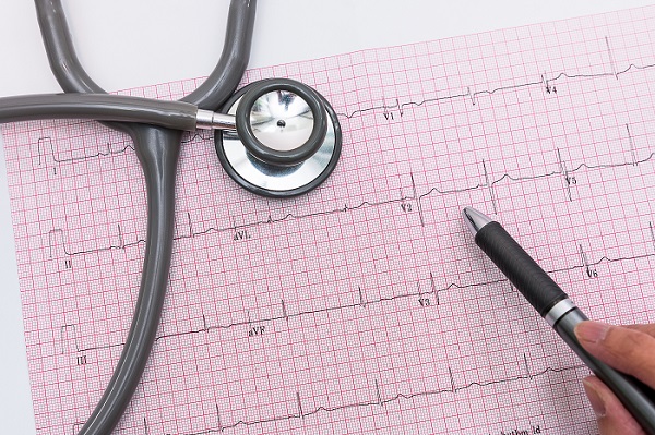 ECG Interpretation: How to Read an Electrocardiogram